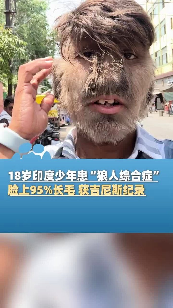 解雨臣被狂c躁到高潮的相关介绍